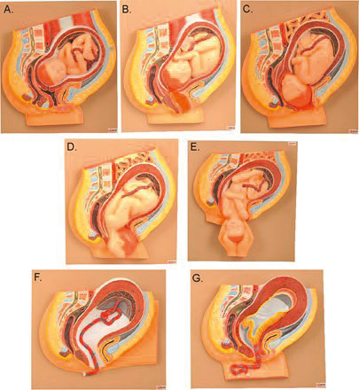 Schéma global du modèle biomécanique de l'accouchement. ABD
