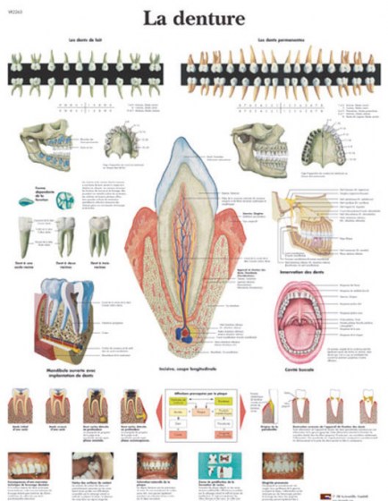 denture