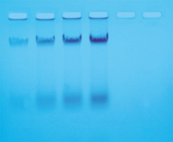 isolement-adn-e-coli